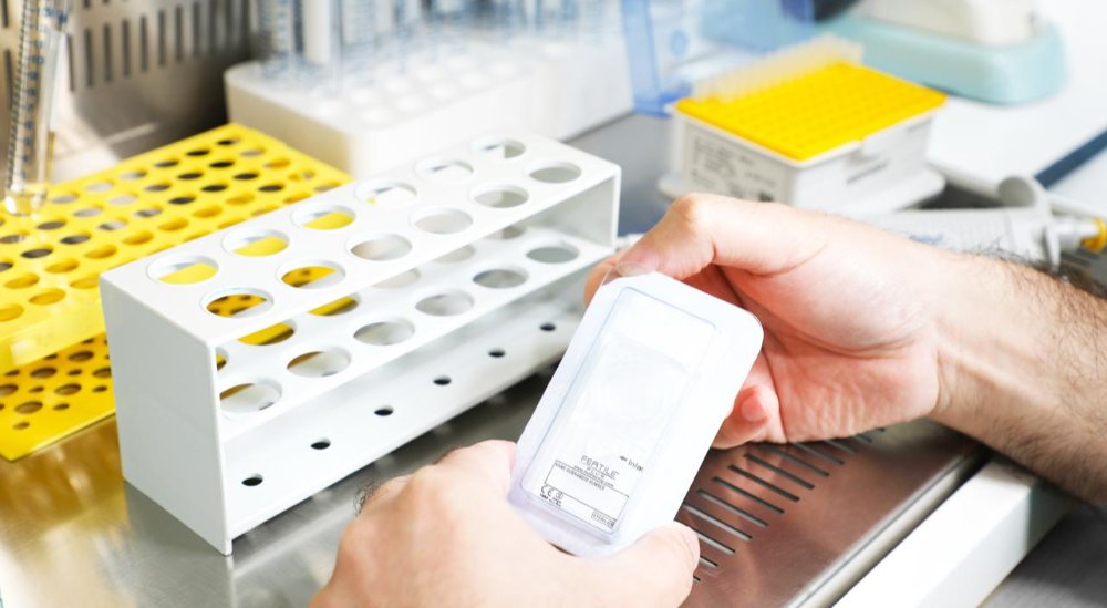 Illustration of advanced sperm selection using Zymot technology to improve IVF outcomes in male infertility.