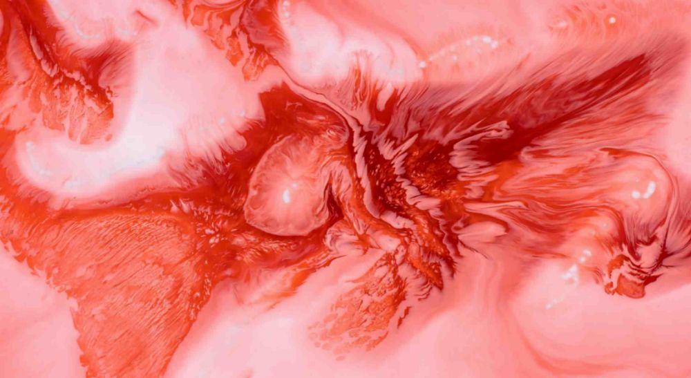 Young women suffering from endometriosis should undergo egg freezing in Azoury IVF lebanon clinic