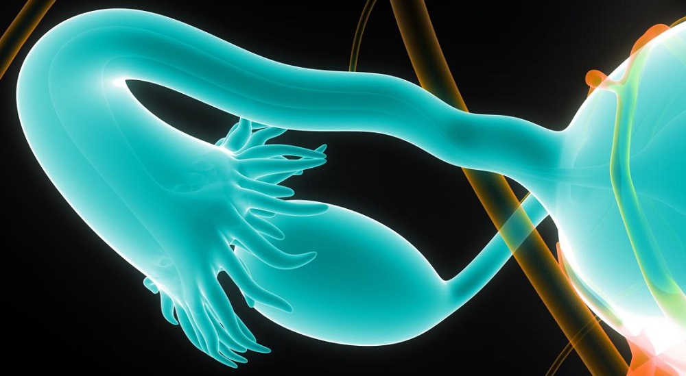when fallopian tubes are blocked the best solution is undergoing IVF
