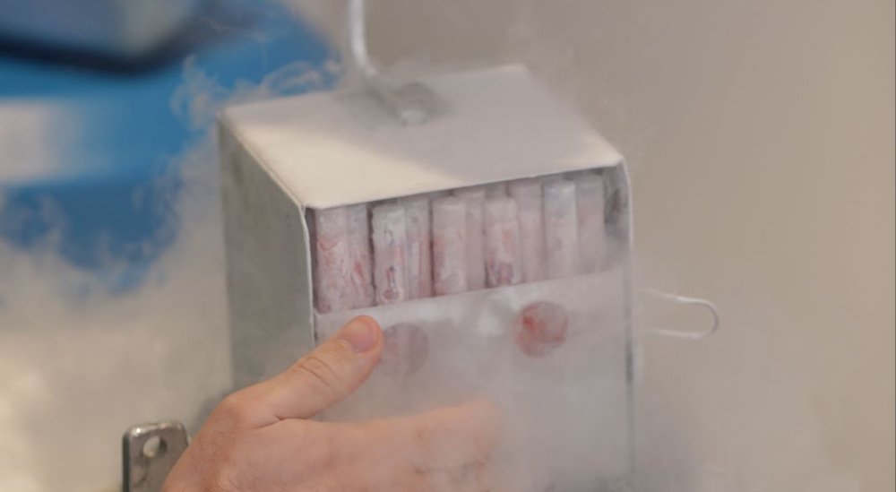 Egg freezing process using cryogenic storage in IVF laboratory at Azoury IVF Clinic
