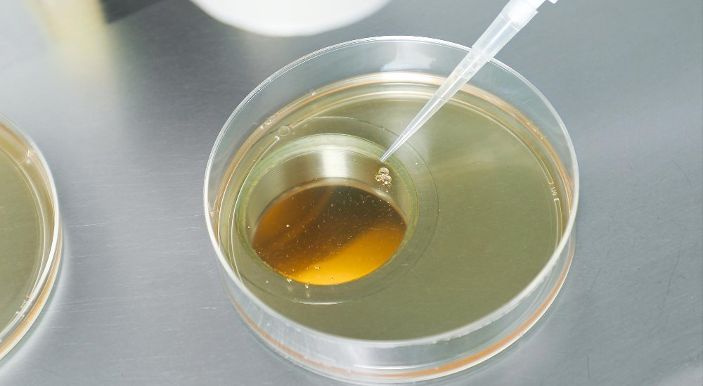 IVF Explained: How In Vitro Fertilization Helps Couples Conceive IVF Explained: How In Vitro Fertilization Helps Couples Conceive