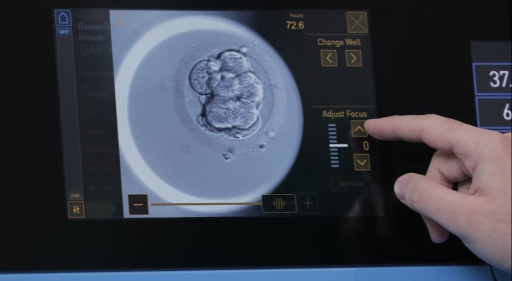 Time-lapse embryo monitoring showing embryo development inside an IVF laboratory incubator. Time-lapse embryo monitoring showing embryo development inside an IVF laboratory incubator.