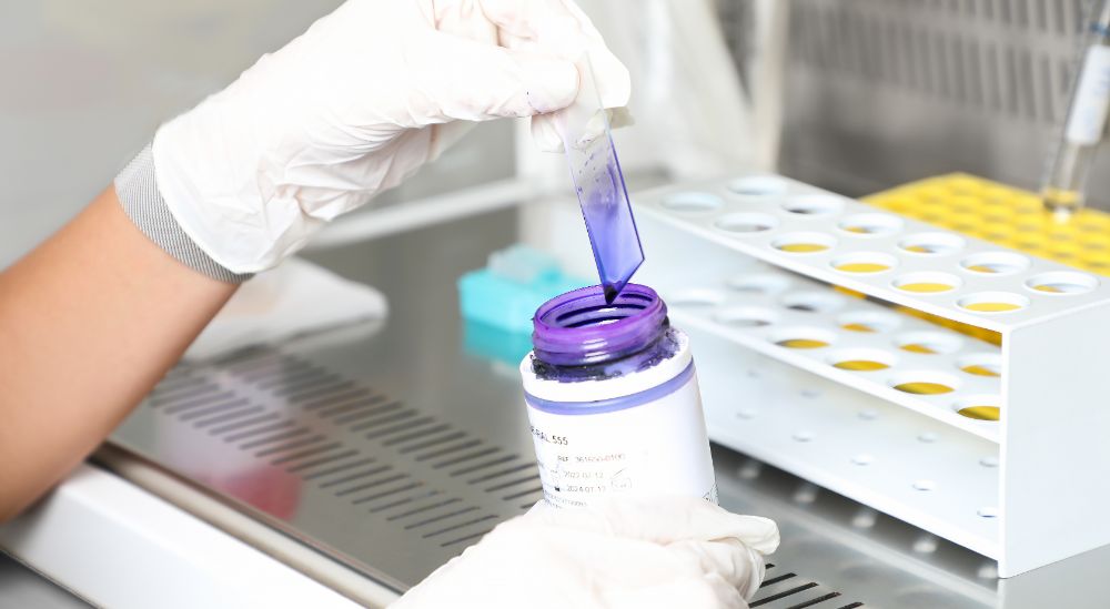 Azoury IVF Lebanon Clinic andrologist performing a semen analysis